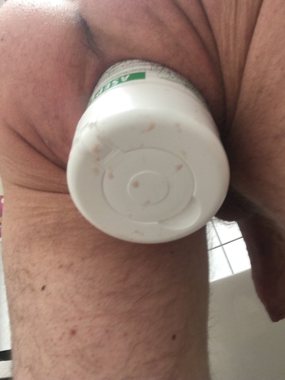Défonce anal