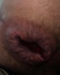 Défonce anal photo