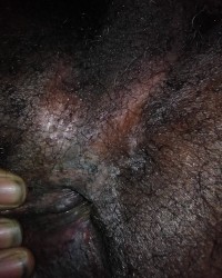 Open ass photo