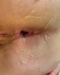 Anal shots photo