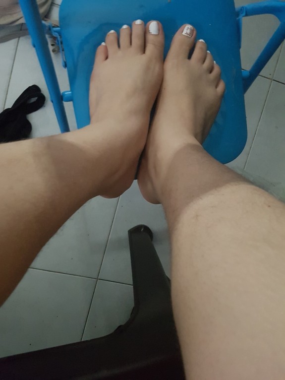 My Ugly Feet