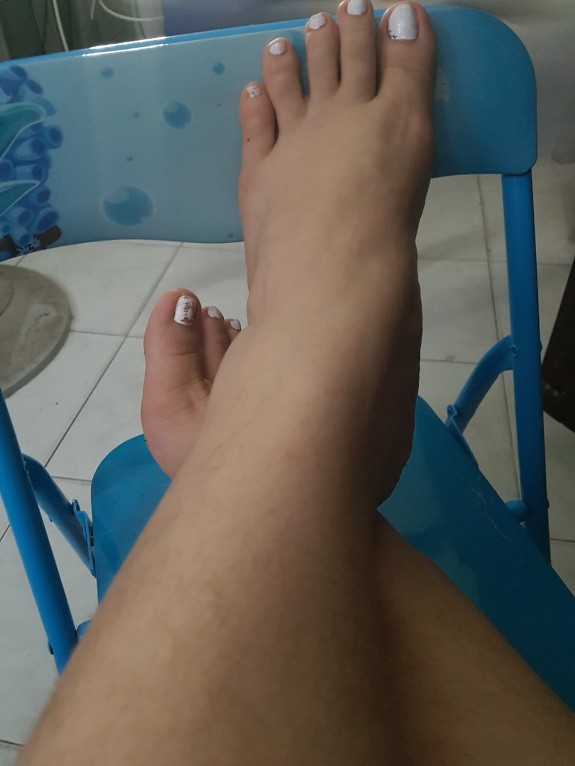 My Ugly Feet
