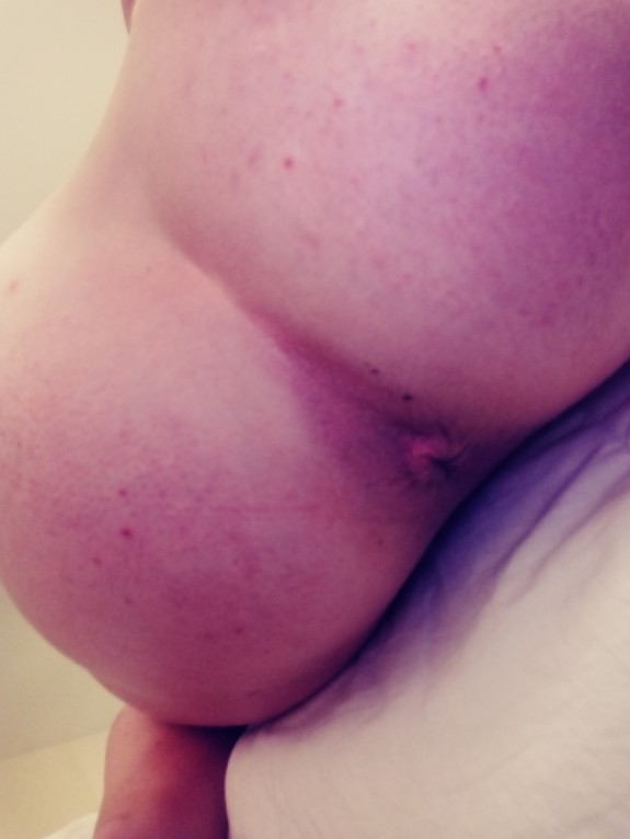 Ts snowbunny. Fat ass