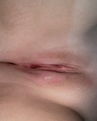 Snapchat Nudes  photo