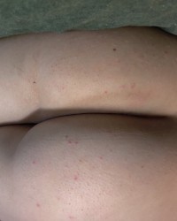 Some teaser pics  photo