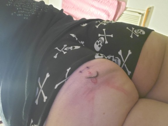 Got my ass tattooed