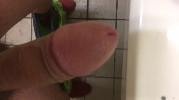 Foreskin penis