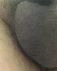 Foreskin penis photo