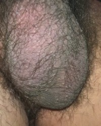 Foreskin penis photo