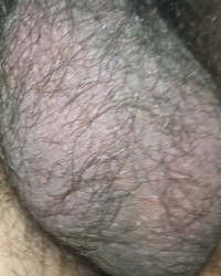 Foreskin penis photo