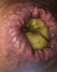 Divers hard gode bite pomme photo