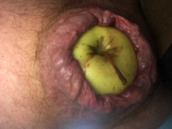 Divers hard gode bite pomme