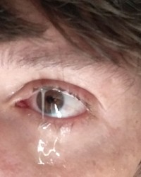 Skinny Guy's Body photo