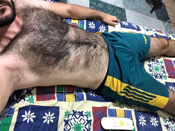 Very hairy man