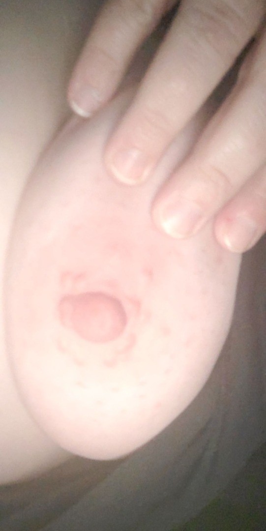 Topless titties