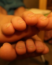 Natural Nails Toe Wiggling photo