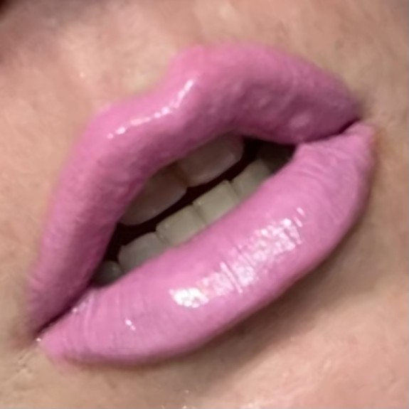 Plumped up pink lips