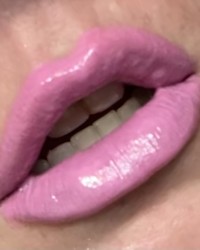 Plumped up pink lips photo