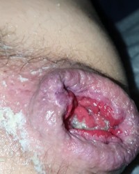 Hardcore anal photo