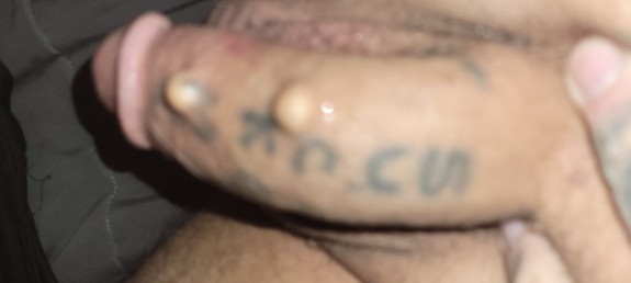 marble implants ,big dick photo