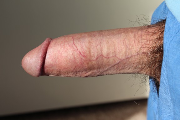 2014 Vintage Pics Of My Cock