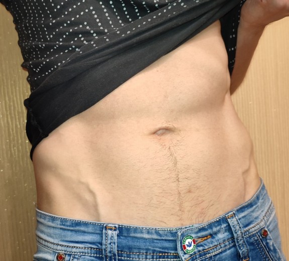 My fotos