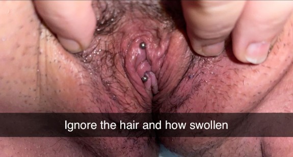 Swollen