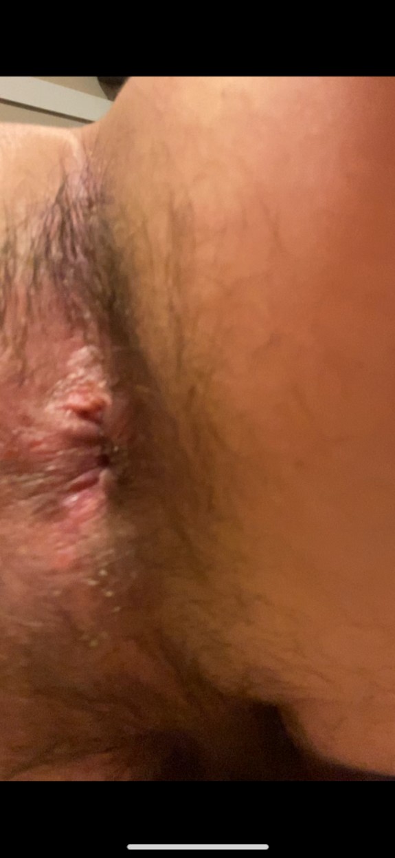 Butthole