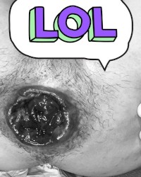 Prolapse photo