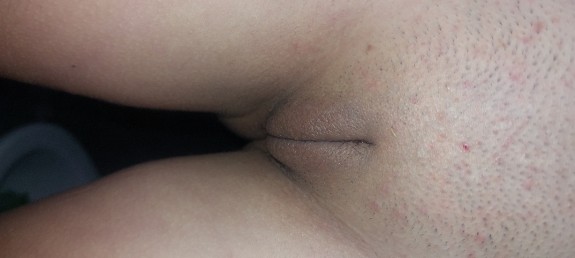 Misfotos
