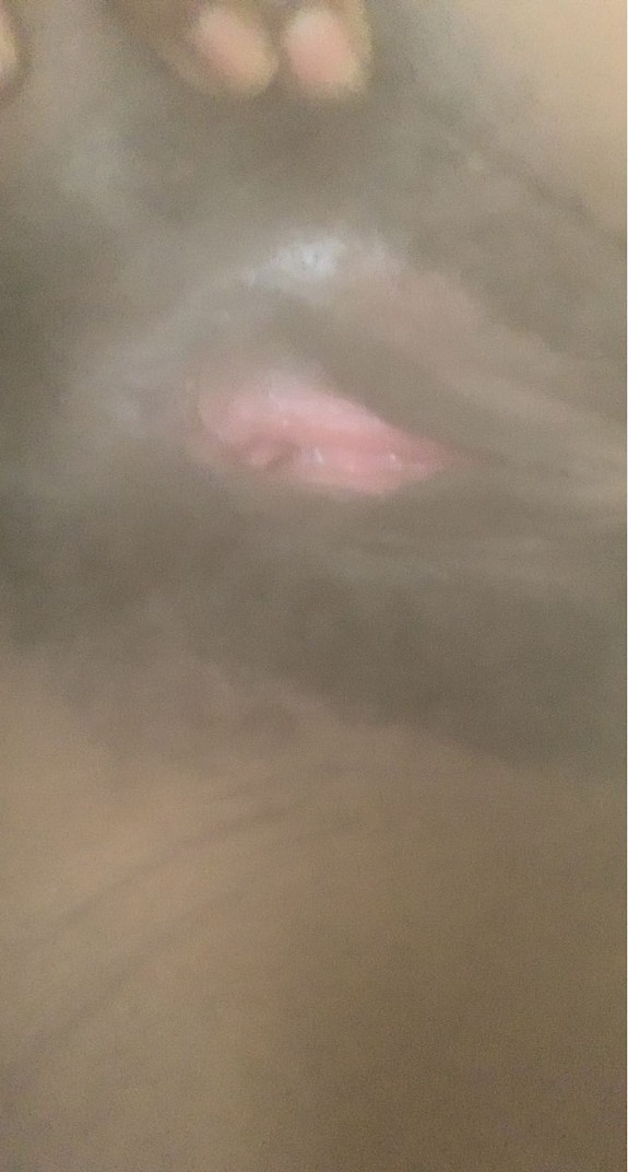 Pussy Pics