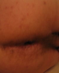 dirkhot photo