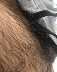 pelos no sol de manha photo