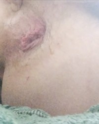 🍑Hole in ass🍑 photo