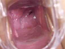 #cervix deep #masturbation gif