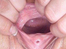 показала шейку маткии gif