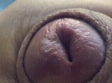 Foreskin stroking gif