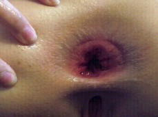 anal gape gif