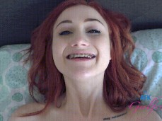 oface with braces gif