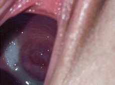 Cum inside pussy cervix view gif