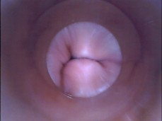 endoscope pussy cervix gif
