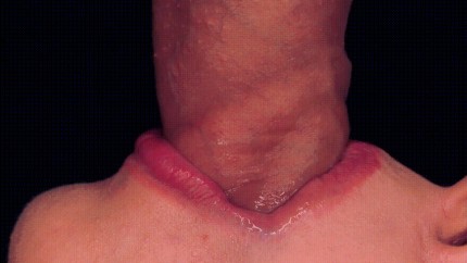 foreskin licking