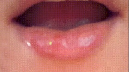 kisses