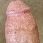 FullovHell