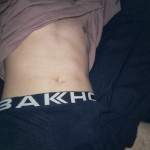pattcam