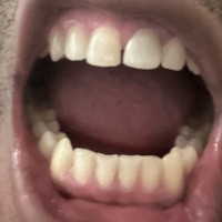 NuJackTrippa