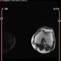 CD Luna
