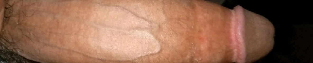 Adamspika