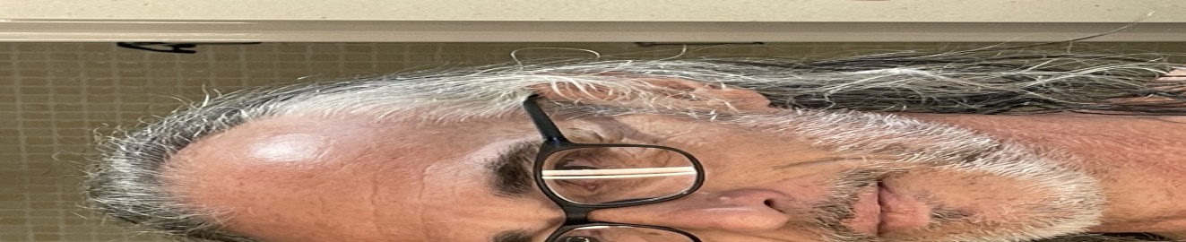 McAxelfoli