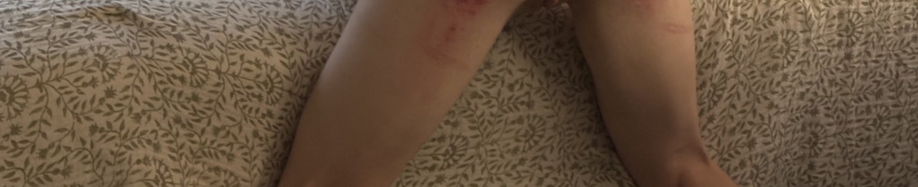 Gary GuyGags and the Pink Twink